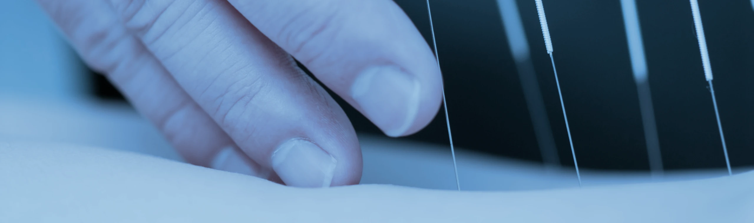 Dry Needling / Medical Acupuncture in Charlotte, NC